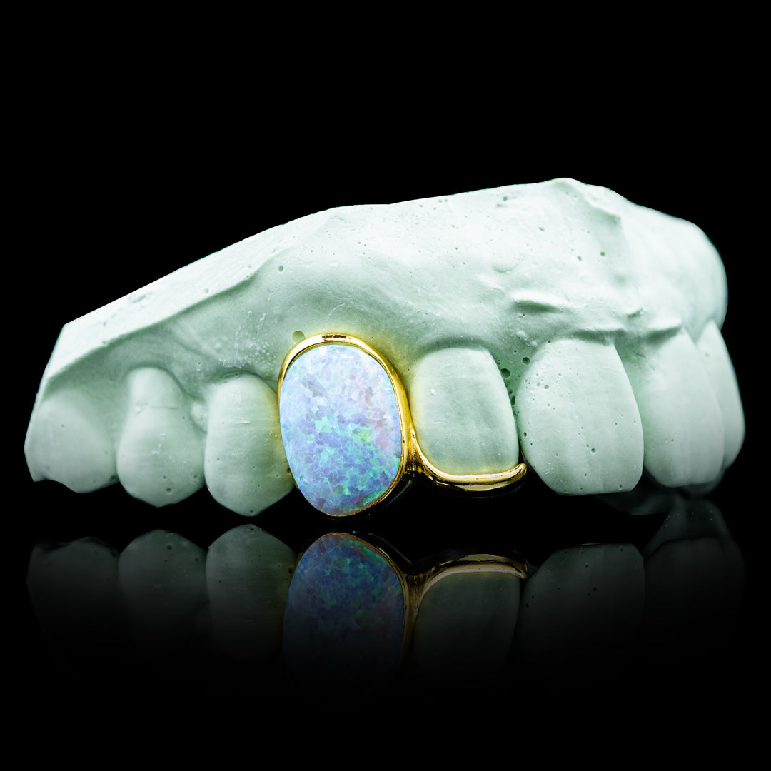 Opal solid tip double cap grillz set, polished enamel, sleek design, luxury dental jewelry.