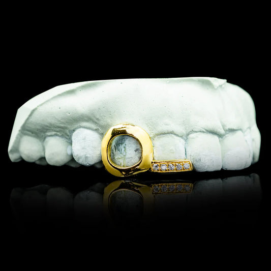 Open Face Heart with Iced Tip Double Cap Gold Grillz