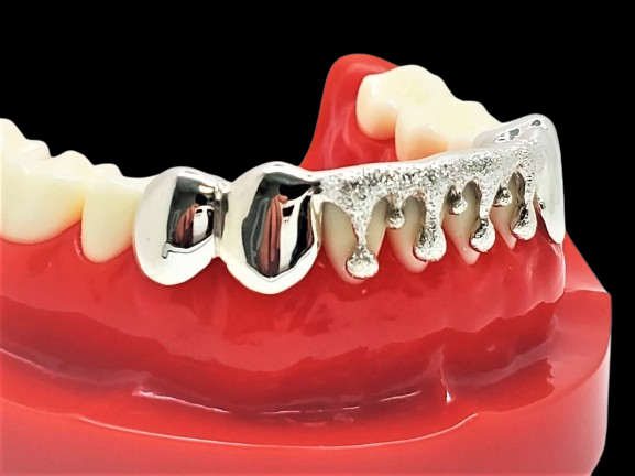 Custom Grillz, Solid Sterling Silver Drip Dripping With Diamond Dust Cut Grillz