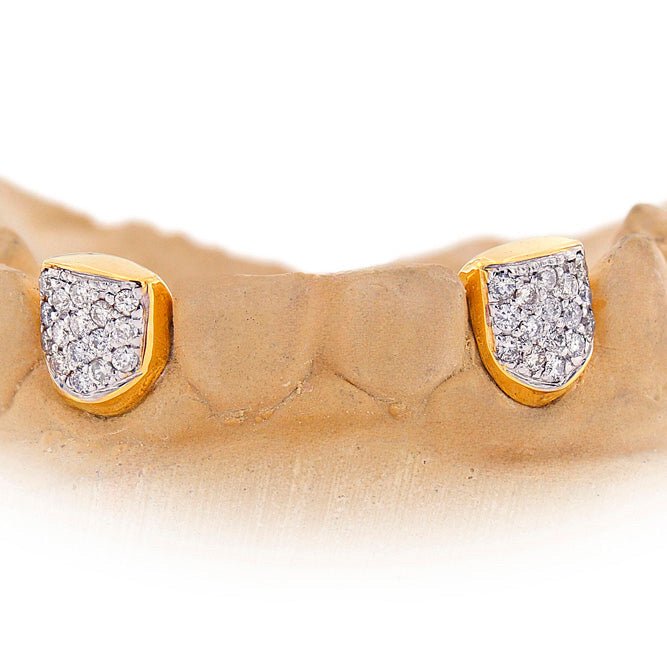 Custom 2 Teeth Incisors Diamond Grillz with Back Bar - Premium Authentic Fit
