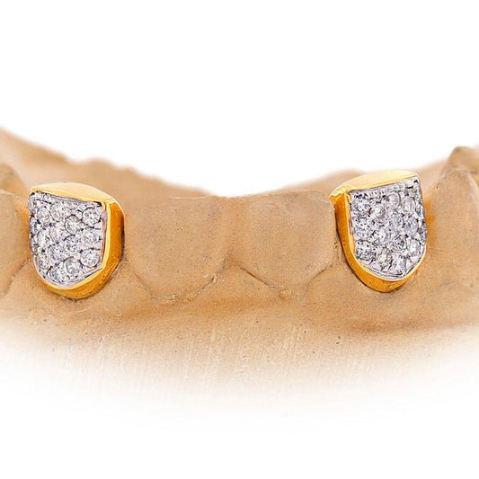 Custom 2 Teeth Incisors Diamond Grillz with Back Bar - Premium Authentic Fit