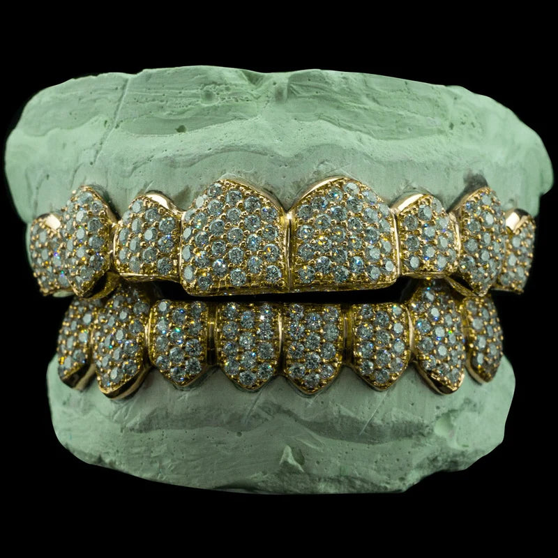 Custom Iced VVS Moissanite Zig Zag Setting Grillz
