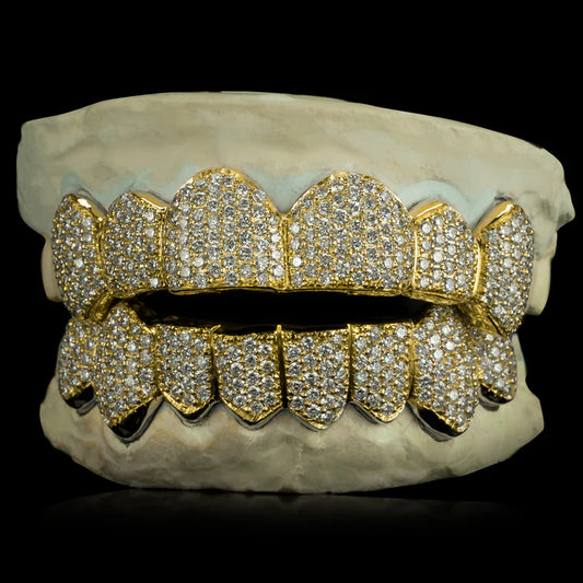 Custom Canary Diamond Grillz - Solid Gold Zig-Zag Setting