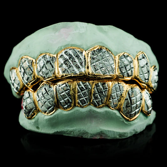 Custom Two-Tone Diamond Cut & Diamond Dust Solid Gold Grillz