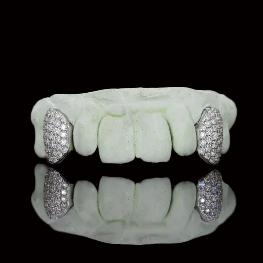 Custom Fangs VVS Moissanite Grillz
