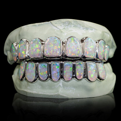 Opal grillz set showcasing polished opal gems on custom metal frame