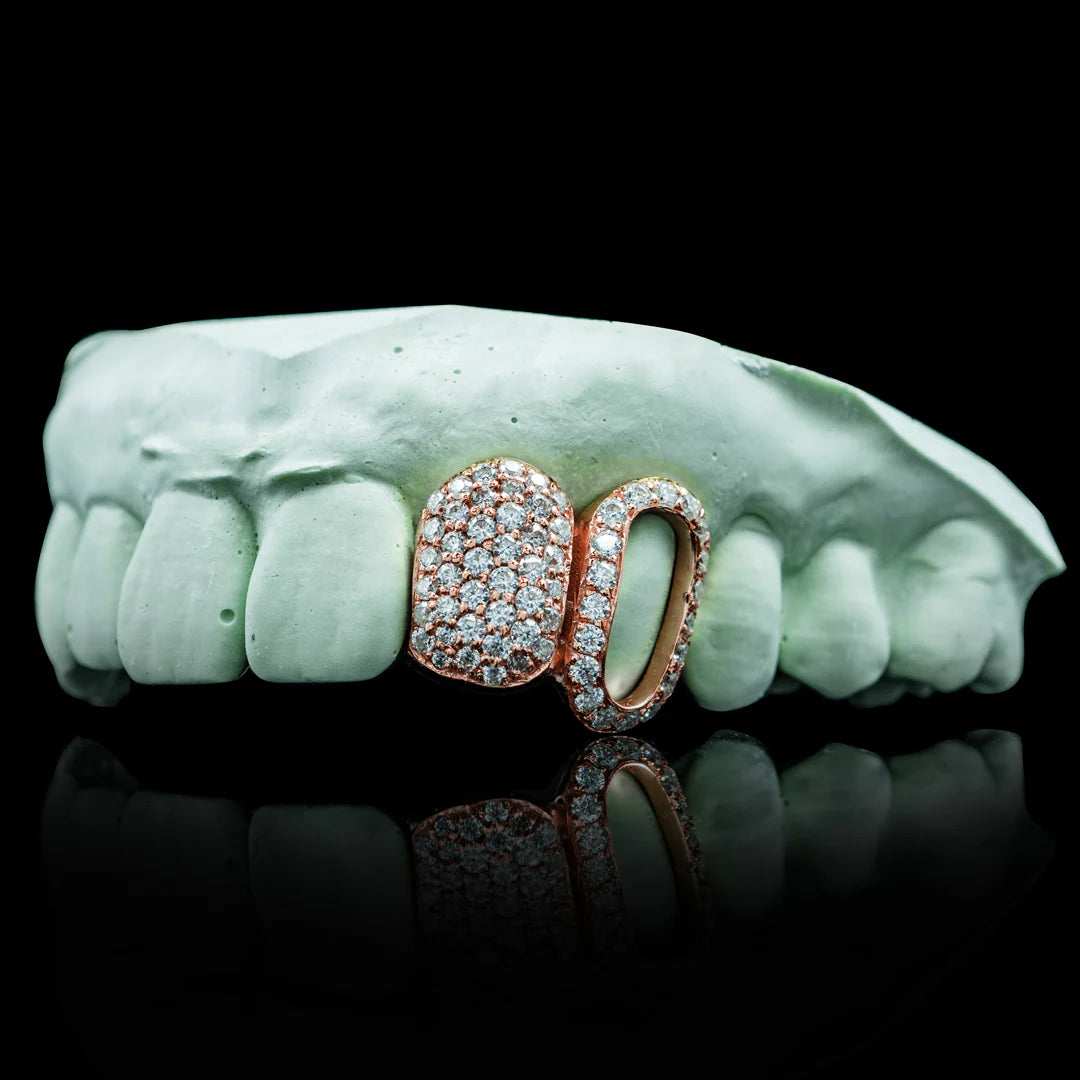 Custom Iced Open Face Double Cap Grillz
