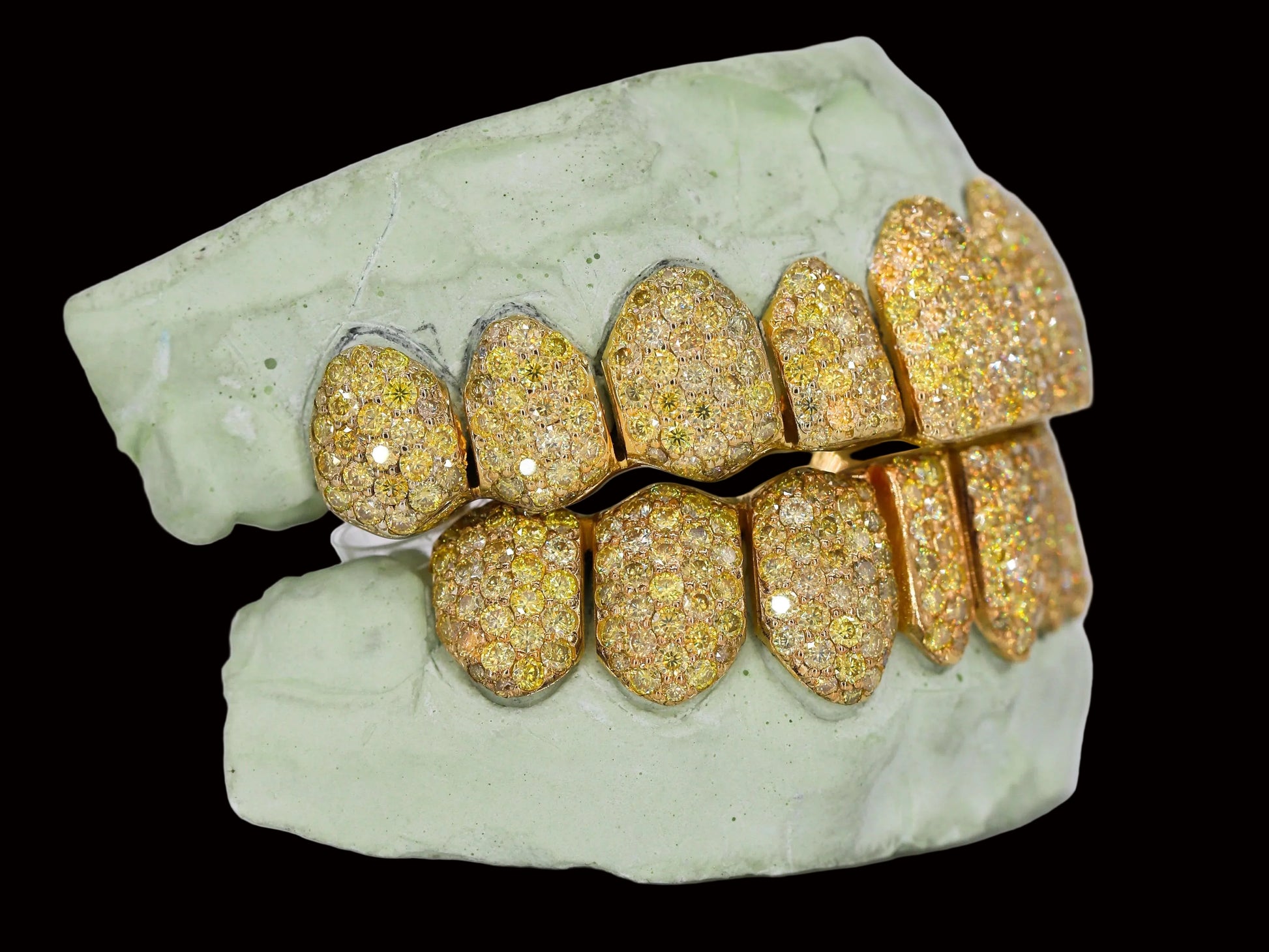 VVS  Yellow Canary Moissanite Diamond Grillz