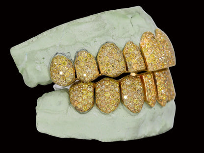 VVS  Yellow Canary Moissanite Diamond Grillz