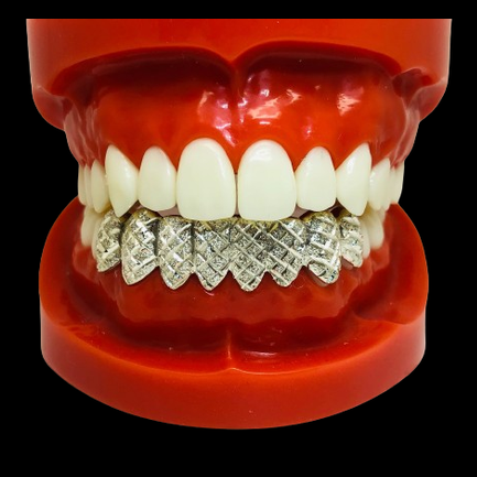10K Solid Gold Diamond Cut + Dust Grillz