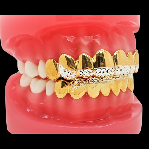 18K Gold Plated Silver Princess Diamond Cut Grillz Set on Dental Model
