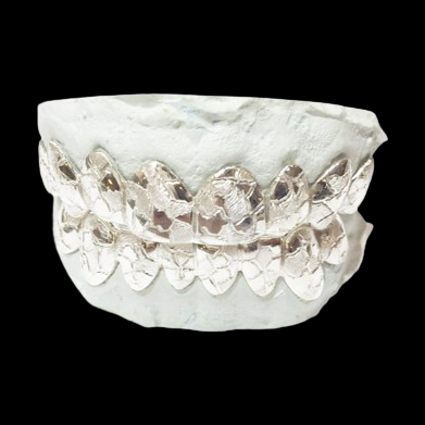 Full arch set of real silver nugget cut grillz for upper and lower teeth