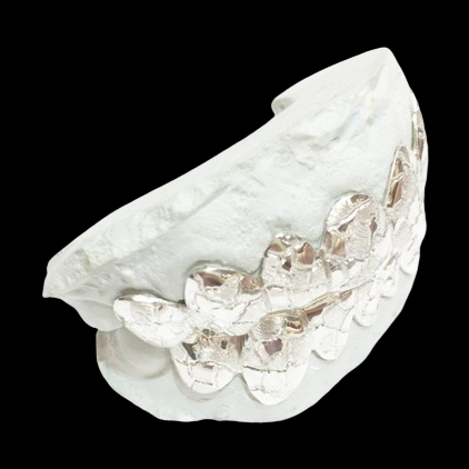 Side view of custom fit 925 sterling silver nugget cut grillz on dental mold