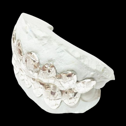 Rear detail of handmade silver nugget cut grillz showing faceted texture and fit