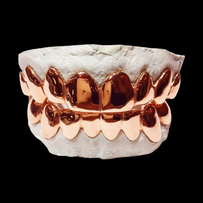 6-piece custom rose gold plated grillz set on dental model