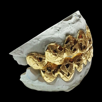 Custom 10K Solid w/ Nugget Cut Gold Grillz
