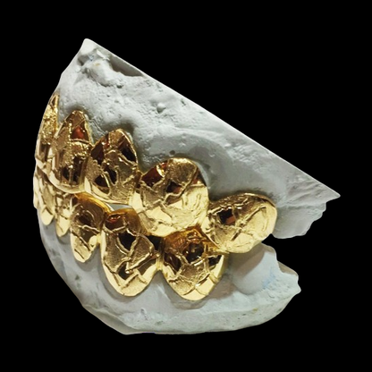 Custom 10K Solid w/ Nugget Cut Gold Grillz