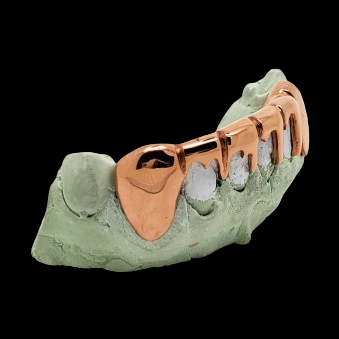 Side profile of solid silver grillz with tapered drip design and molar cap