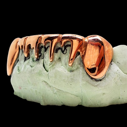 Close-up of custom yellow rose silver dripping grillz on dental mold