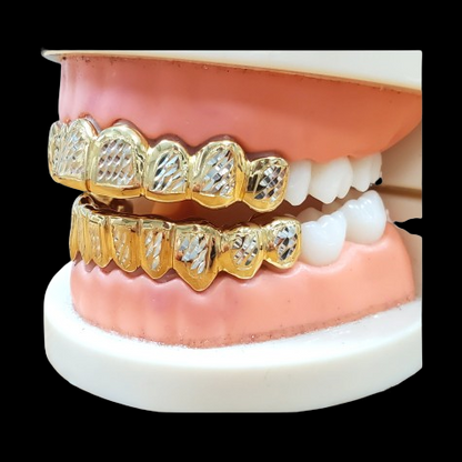 Fitted two-tone diamond cut grillz on dental model showing precise upper and lower arch alignment