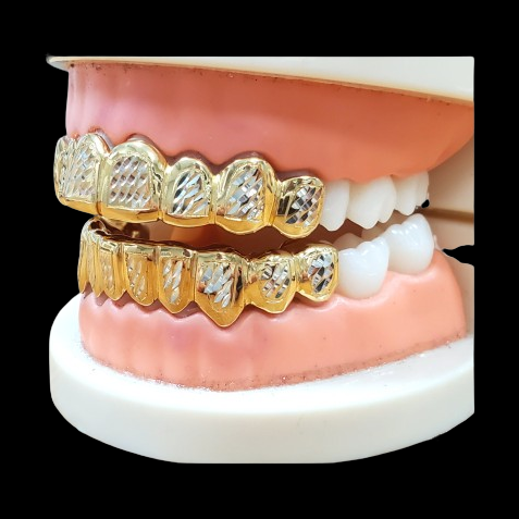 Side profile of snug-fitting two-tone diamond cut grillz with 18K gold frames on dental model