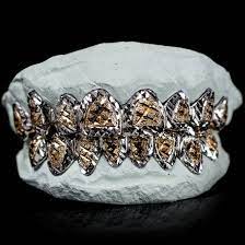 Custom Grillz, Diamond dust, 925 Silver - Real 14K Gold, Silver 925, 10K, & 14K Gold