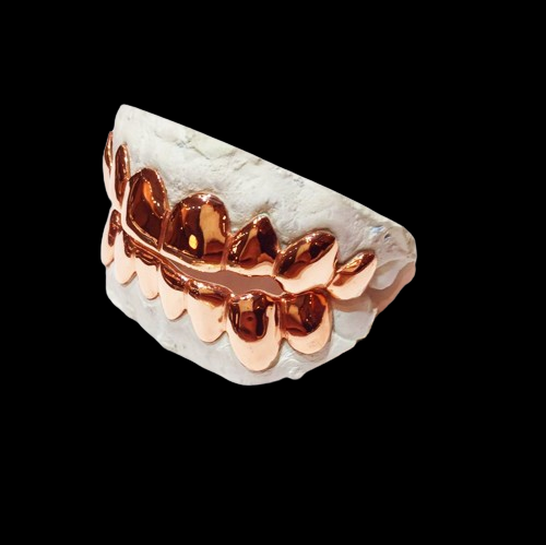 925 Sterling Silver with 18K Rose Gold Plated Custom Real Grillz