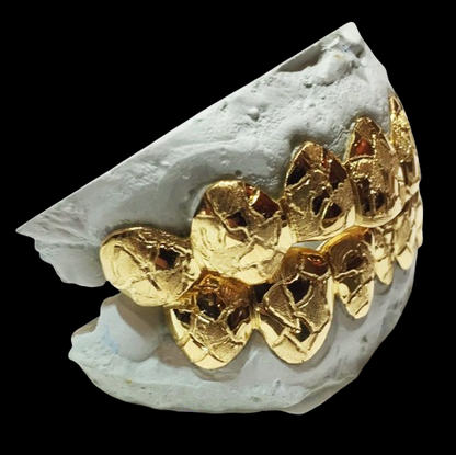 Custom Grillz, Solid 10 Karat Yellow Gold w/ Nugget Cut Grillz