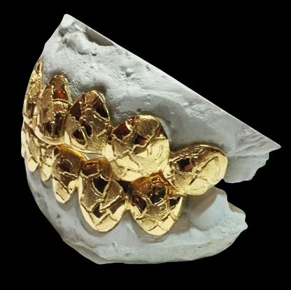 Custom Grillz, Solid 10 Karat Yellow Gold w/ Nugget Cut Grillz