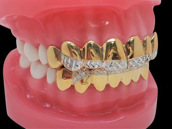 925 Solid Sterling Silver 18K Yellow Gold Plated Dust+Diamond Cut Grillz